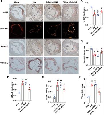 Activin receptor-like kinase 7 promotes apoptosis of vascular smooth muscle cells via activating Smad2/3 signaling in diabetic atherosclerosis